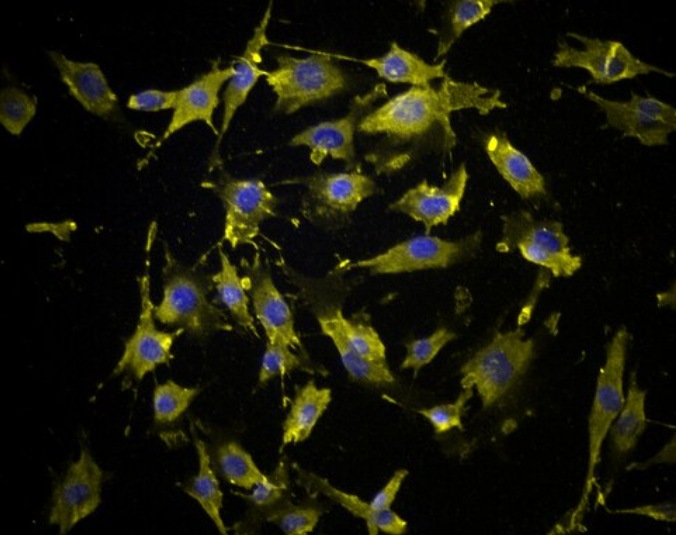 人直肠癌组织源细胞