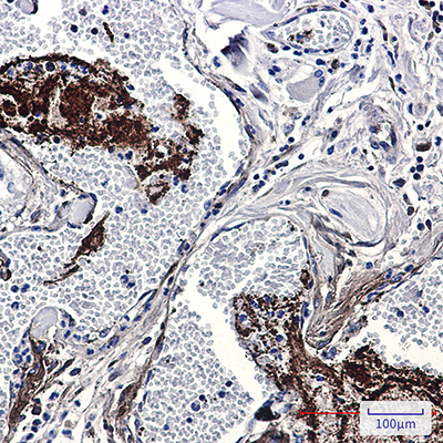 Thrombospondin 1 Rabbit Monoclonal Antibody | 兔单抗 | EnkiLife恩玑生命