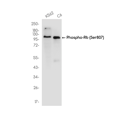Phospho-Rb (Ser807) Rabbit Monoclonal Antibody | 兔单抗 | EnkiLife恩玑生命