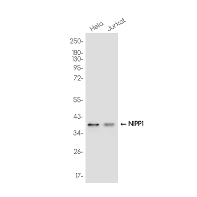 NIPP1 Rabbit Monoclonal Antibody | 兔单抗 | EnkiLife恩玑生命