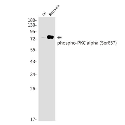 Phospho-PKC alpha (Ser657) Rabbit Monoclonal Antibody | 兔单抗 | EnkiLife恩玑生命