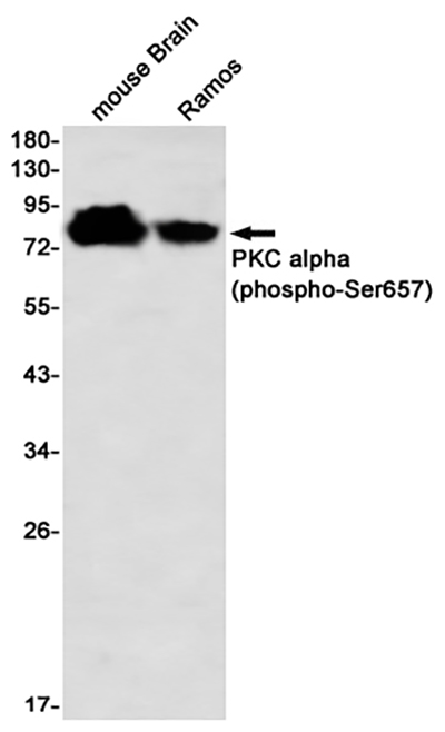 Phospho-PKC alpha (Ser657) Rabbit Monoclonal Antibody | 兔单抗 | EnkiLife恩玑生命