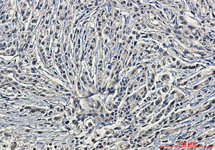 Phospho-PKC alpha (Ser657) Rabbit Monoclonal Antibody | 兔单抗 | EnkiLife恩玑生命
