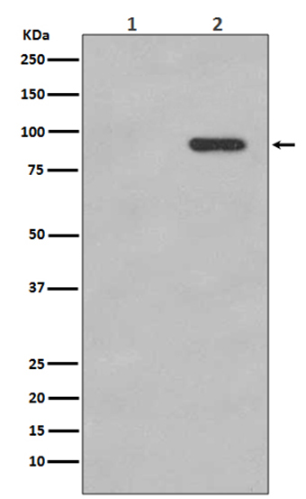 Phospho-beta Catenin (S33/S37) (7V18) Rabbit Monoclonal Antibody | 兔单抗 | EnkiLife恩玑生命