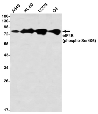 Phospho-eIF4B (Ser406) (13H6) Rabbit Monoclonal Antibody | 兔单抗 | EnkiLife恩玑生命