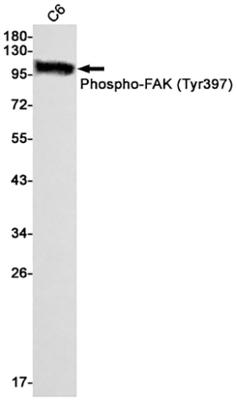 Phospho-FAK (Y397) (10H3) Rabbit Monoclonal Antibody | 兔单抗 | EnkiLife恩玑生命
