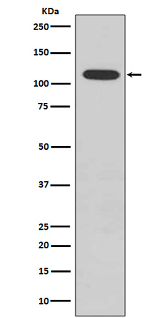 Phospho-Retinoblastoma (S807)  (4H3) Rabbit Monoclonal Antibody | 兔单抗 | EnkiLife恩玑生命