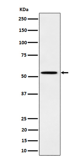 Phospho-Src (Y529) (9B14) Rabbit Monoclonal Antibody | 兔单抗 | EnkiLife恩玑生命