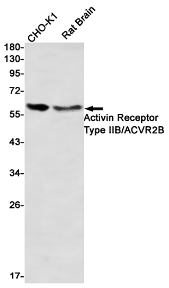 Activin Receptor Type IIB/ACVR2B (2S5) Rabbit Monoclonal Antibody | 兔单抗 | EnkiLife恩玑生命