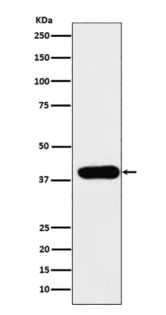 ADA (11N15) Rabbit Monoclonal Antibody | 兔单抗 | EnkiLife恩玑生命