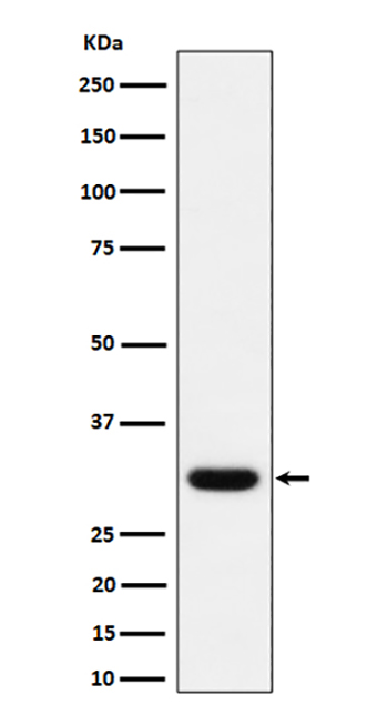Adiponectin (5N3) Rabbit Monoclonal Antibody | 兔单抗 | EnkiLife恩玑生命