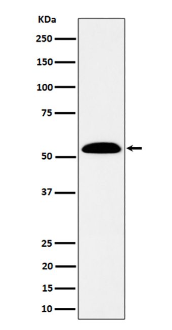 ALDH7A1 (14K11) Rabbit Monoclonal Antibody | 兔单抗 | EnkiLife恩玑生命