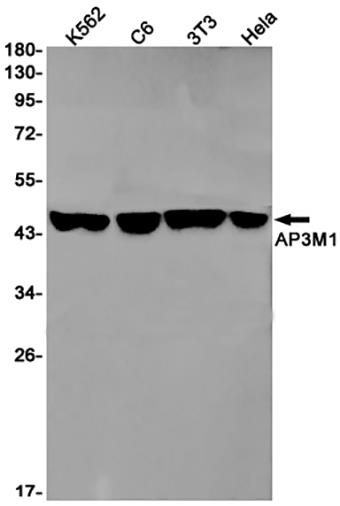 AP3M1 (16F4) Rabbit Monoclonal Antibody | 兔单抗 | EnkiLife恩玑生命