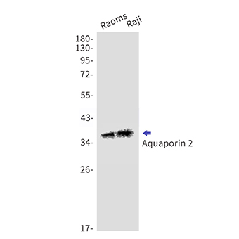 Aquaporin 2 (13E19) Rabbit Monoclonal Antibody | 兔单抗 | EnkiLife恩玑生命