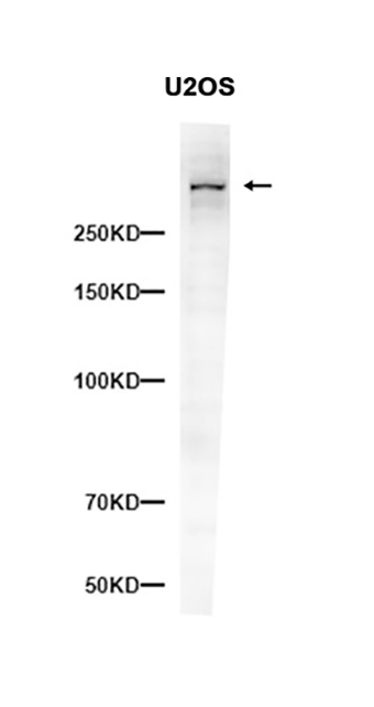 ATM (2G7) Rabbit Monoclonal Antibody | 兔单抗 | EnkiLife恩玑生命