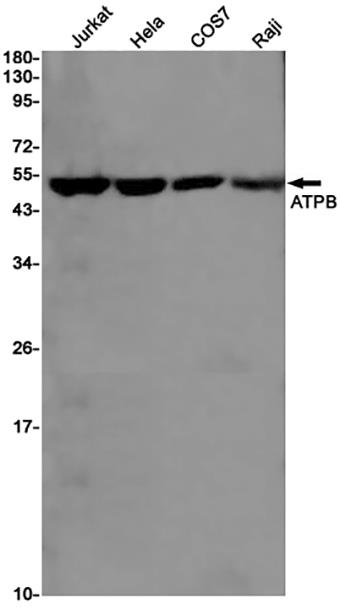 ATPB (19W10) Rabbit Monoclonal Antibody | 兔单抗 | EnkiLife恩玑生命