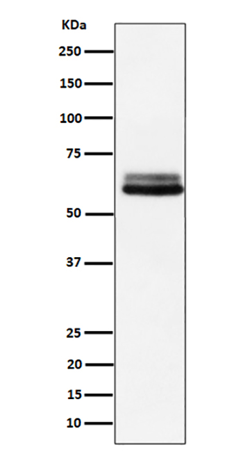 BIN1 (14G10) Rabbit Monoclonal Antibody | 兔单抗 | EnkiLife恩玑生命