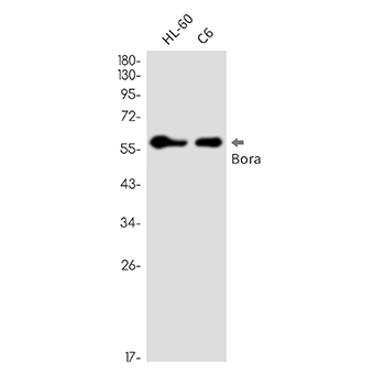Caldesmon (3X14) Rabbit Monoclonal Antibody | 兔单抗 | EnkiLife恩玑生命