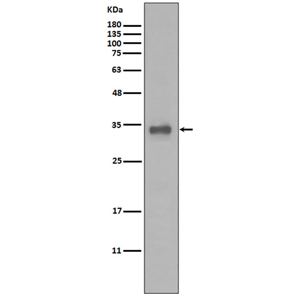 Calponin  (6N15) Rabbit Monoclonal Antibody | 兔单抗 | EnkiLife恩玑生命