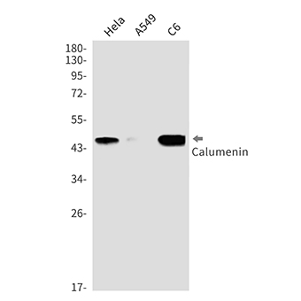 Calumenin (14E19) Rabbit Monoclonal Antibody | 兔单抗 | EnkiLife恩玑生命