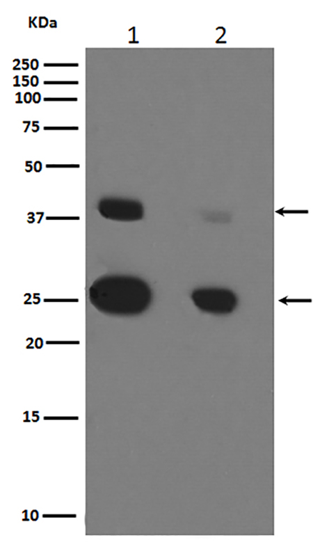 Cathepsin D (11F19) Rabbit Monoclonal Antibody | 兔单抗 | EnkiLife恩玑生命