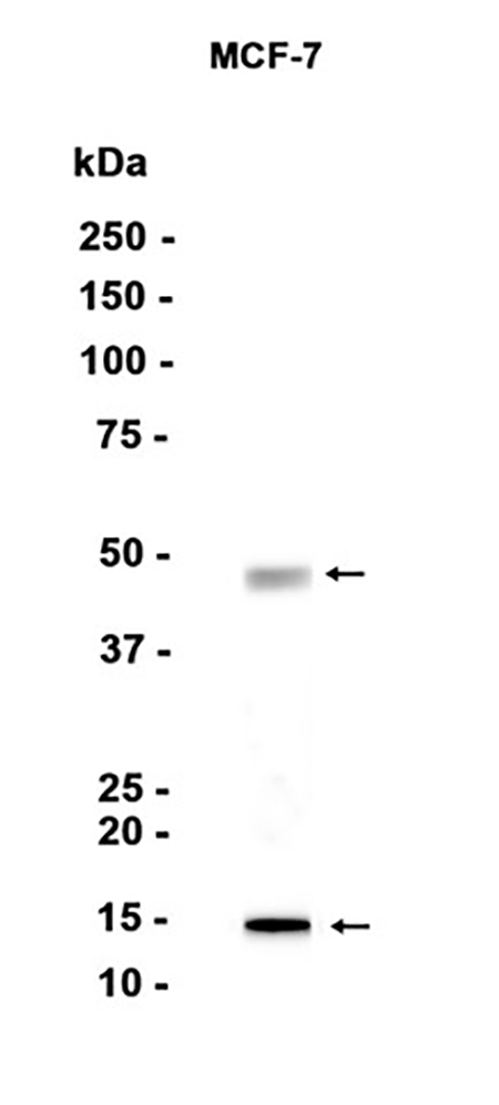 Cathepsin D (11F19) Rabbit Monoclonal Antibody | 兔单抗 | EnkiLife恩玑生命