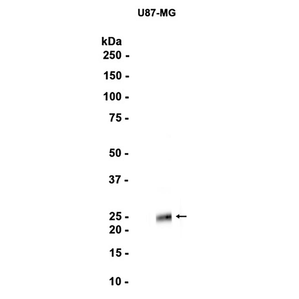 Cathepsin S (16H3) Rabbit Monoclonal Antibody | 兔单抗 | EnkiLife恩玑生命