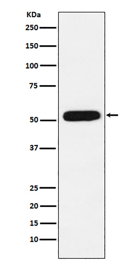 CBX4 (10P4) Rabbit Monoclonal Antibody | 兔单抗 | EnkiLife恩玑生命