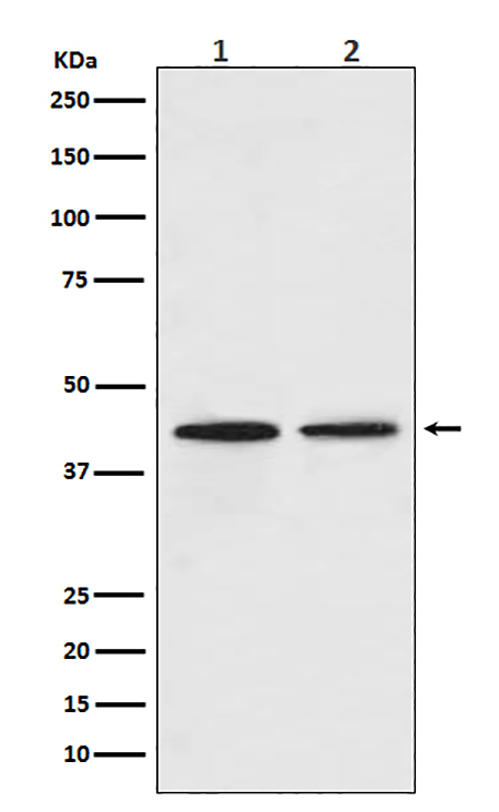 CCR9 (11E6) Rabbit Monoclonal Antibody | 兔单抗 | EnkiLife恩玑生命
