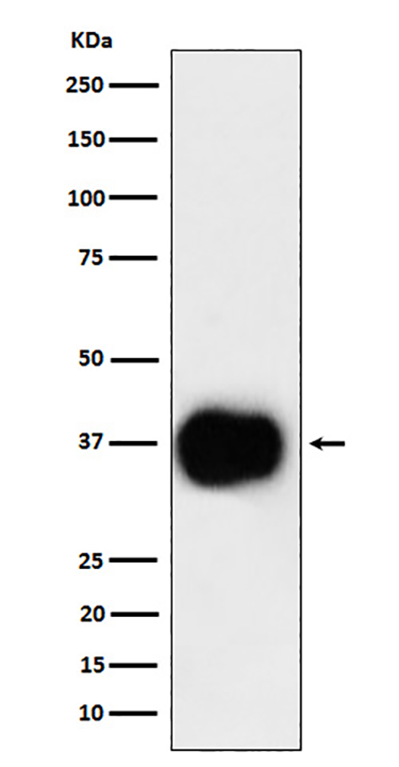 CD79b (1O8) Rabbit Monoclonal Antibody | 兔单抗 | EnkiLife恩玑生命
