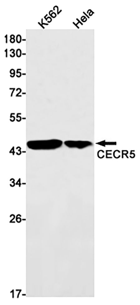 CECR5 (17M19) Rabbit Monoclonal Antibody | 兔单抗 | EnkiLife恩玑生命