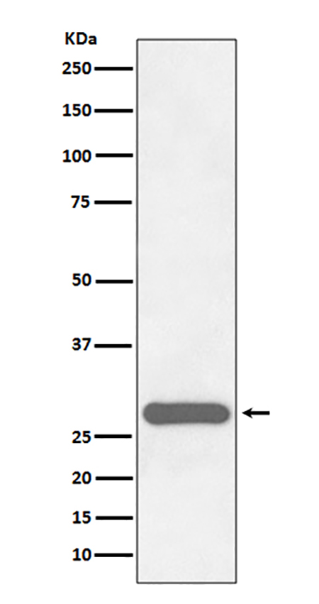 CITED2 (17H2) Rabbit Monoclonal Antibody | 兔单抗 | EnkiLife恩玑生命