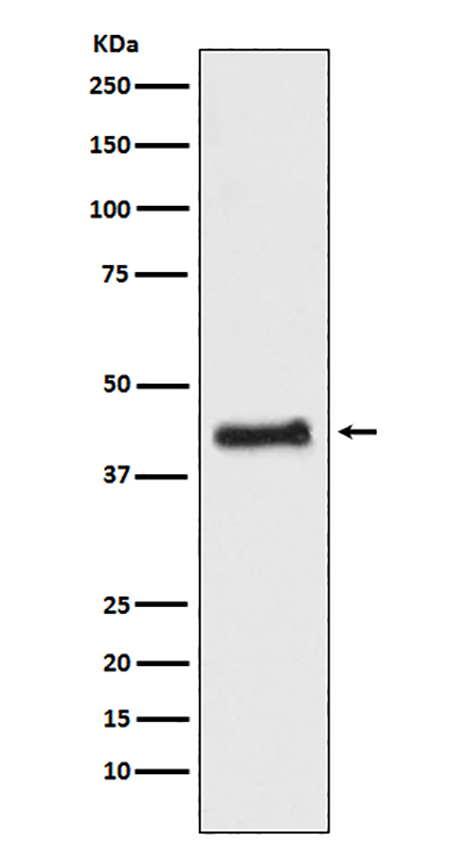 COUP TF1 (17W3) Rabbit Monoclonal Antibody | 兔单抗 | EnkiLife恩玑生命