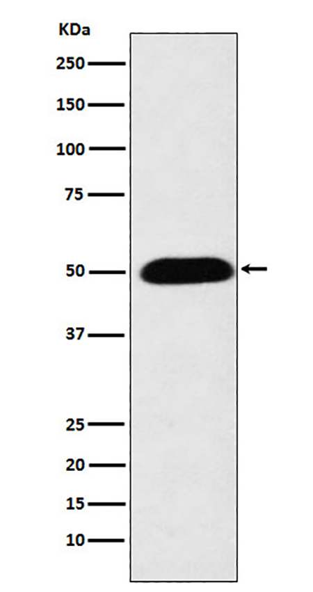 CYP27A1 (5H15) Rabbit Monoclonal Antibody | 兔单抗 | EnkiLife恩玑生命