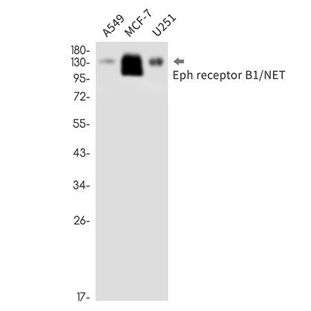 Eph receptor B1 (19N17) Rabbit Monoclonal Antibody | 兔单抗 | EnkiLife恩玑生命