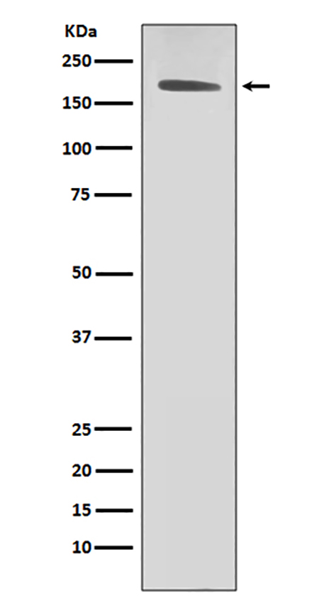 ErbB2 (HER2) (4J7) Rabbit Monoclonal Antibody | 兔单抗 | EnkiLife恩玑生命