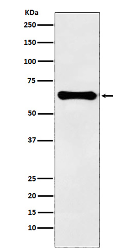 Factor IX  (1L7) Rabbit Monoclonal Antibody | 兔单抗 | EnkiLife恩玑生命