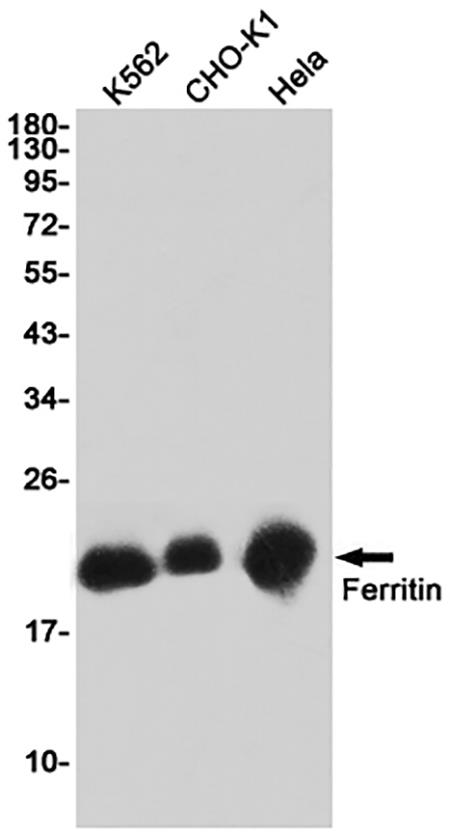 Ferritin (18K15) Rabbit Monoclonal Antibody | 兔单抗 | EnkiLife恩玑生命
