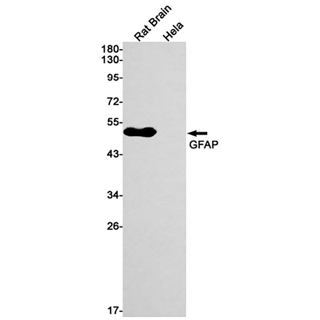 GFAP  (18L1) Rabbit Monoclonal Antibody | 兔单抗 | EnkiLife恩玑生命