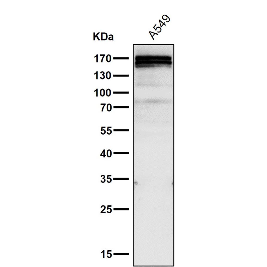 Gli1 (17P5) Rabbit Monoclonal Antibody | 兔单抗 | EnkiLife恩玑生命