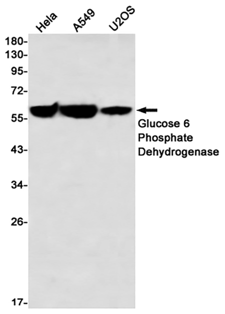 Glucose 6 Phosphate Dehydrogenase (5Y1) Rabbit Monoclonal Antibody | 兔单抗 | EnkiLife恩玑生命