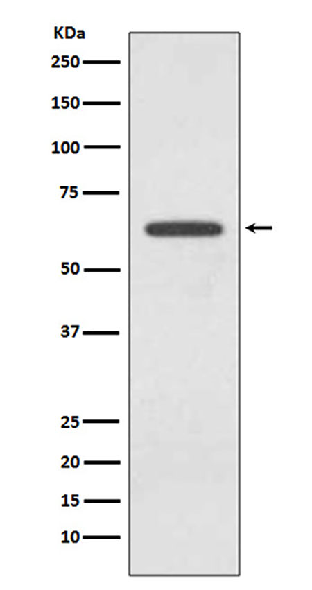 Glutaminase (3F15) Rabbit Monoclonal Antibody | 兔单抗 | EnkiLife恩玑生命