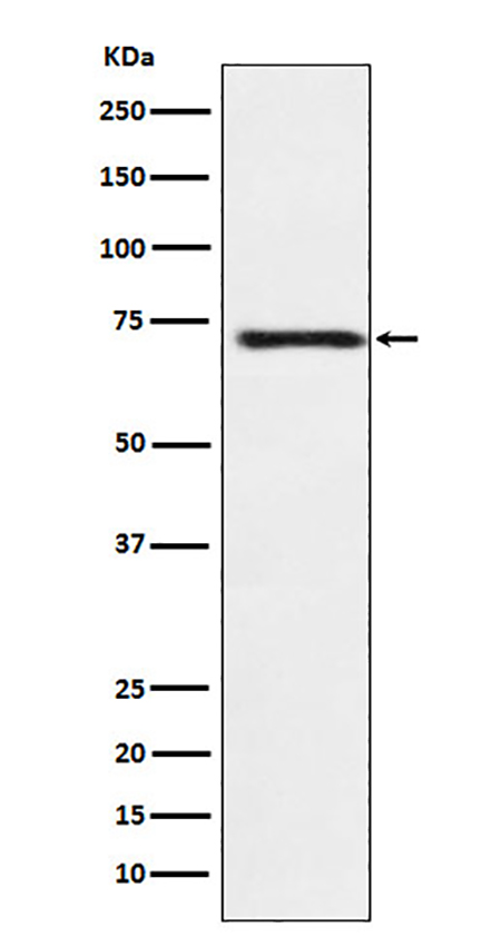 Guanylyl Cyclase beta 1 (19P14) Rabbit Monoclonal Antibody | 兔单抗 | EnkiLife恩玑生命