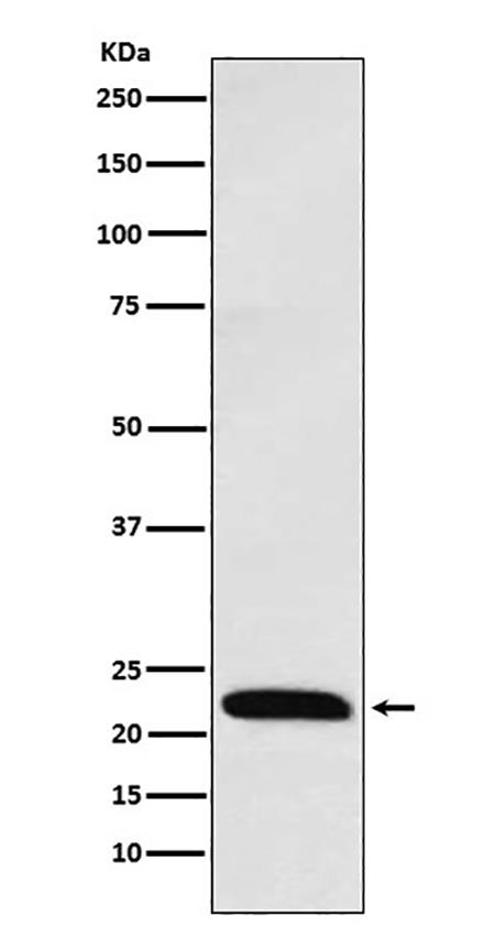 ICOS (16D3) Rabbit Monoclonal Antibody | 兔单抗 | EnkiLife恩玑生命