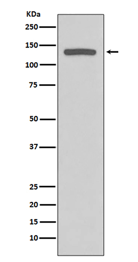 iNOS (12H16) Rabbit Monoclonal Antibody | 兔单抗 | EnkiLife恩玑生命