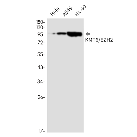 KMT6 / EZH2 (15A18) Rabbit Monoclonal Antibody | 兔单抗 | EnkiLife恩玑生命