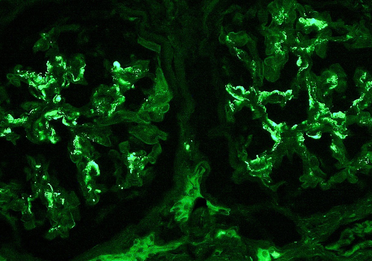 小鼠骨髓瘤细胞P3X63Ag8.653