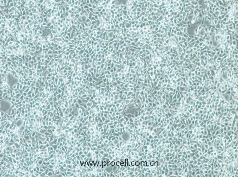 CAL-33细胞 (人舌鳞癌细胞癌) (STR鉴定正确)CL-0952