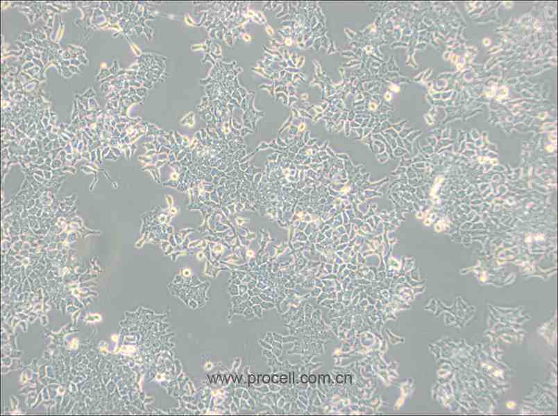 H-4-II-E 细胞[H4-II-E细胞] (大鼠肝细胞瘤) (种属鉴定正确)CL-0088