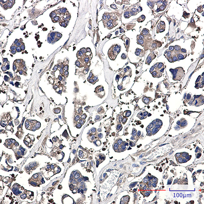 Optineurin (3D13) Rabbit Monoclonal Antibody | 兔单抗 | EnkiLife恩玑生命
